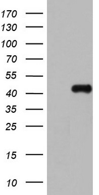 HEK293T cells were transfected with the pCMV6-ENTRY control (Left lane) or pCMV6-ENTRY NRBF2 (Right lane) cDNA for 48 hrs and lysed
