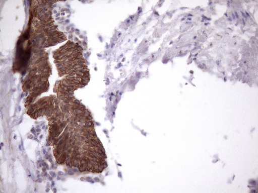 Immunohistochemical staining of paraffin-embedded Human prostate tissue within the normal limits using anti-AMTN mouse monoclonal antibody. (Heat-induced epitope retrieval by 1mM EDTA in 10mM Tris buffer (pH8.5) at 120°C for 3min