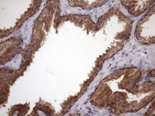Immunohistochemical staining of paraffin-embedded Human bladder tissue within the normal limits using anti-AMTN mouse monoclonal antibody. (Heat-induced epitope retrieval by 1mM EDTA in 10mM Tris buffer (pH8.5) at 120°C for 3min