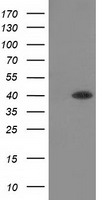HEK293T cells were transfected with the pCMV6-ENTRY control (Left lane) or pCMV6-ENTRY HAO1 (Right lane) cDNA for 48 hrs and lysed