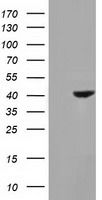 HEK293T cells were transfected with the pCMV6-ENTRY control (Left lane) or pCMV6-ENTRY HAO1 (Right lane) cDNA for 48 hrs and lysed