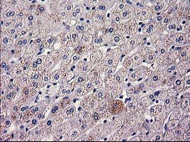 Immunohistochemical staining of paraffin-embedded Human liver tissue within the normal limits using anti-HAO1 mouse monoclonal antibody