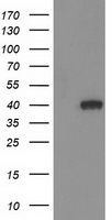 HEK293T cells were transfected with the pCMV6-ENTRY control (Left lane) or pCMV6-ENTRY HAO1 (Right lane) cDNA for 48 hrs and lysed