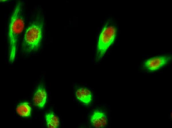 Immunofluorescence analysis of Hela cell