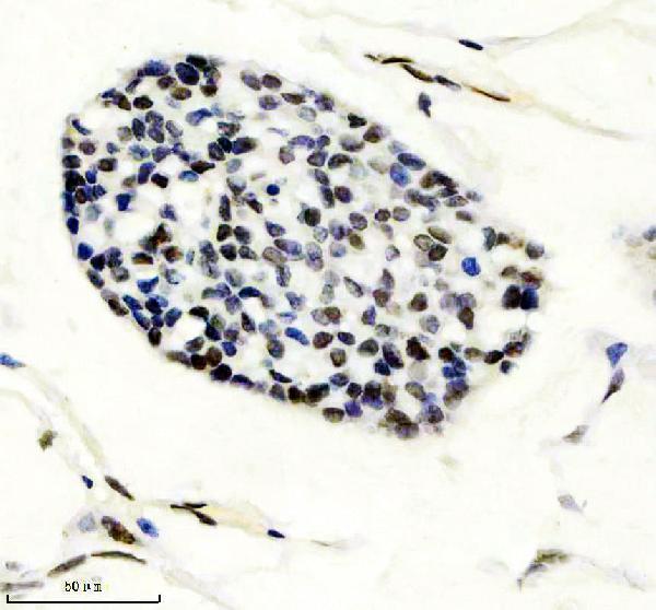 m09194 gatad2a primary antibodies ihc testing 1