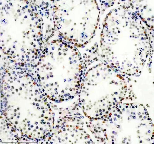IHC analysis of GATAD2A using anti-GATAD2A antibody (M09194)