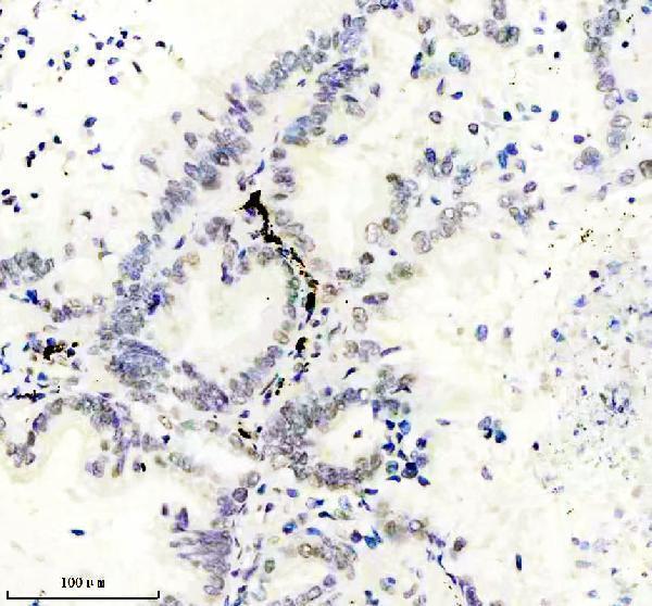 m09194 gatad2a primary antibodies ihc testing 2