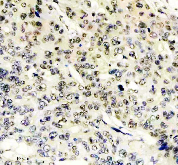 m09194 gatad2a primary antibodies ihc testing 3