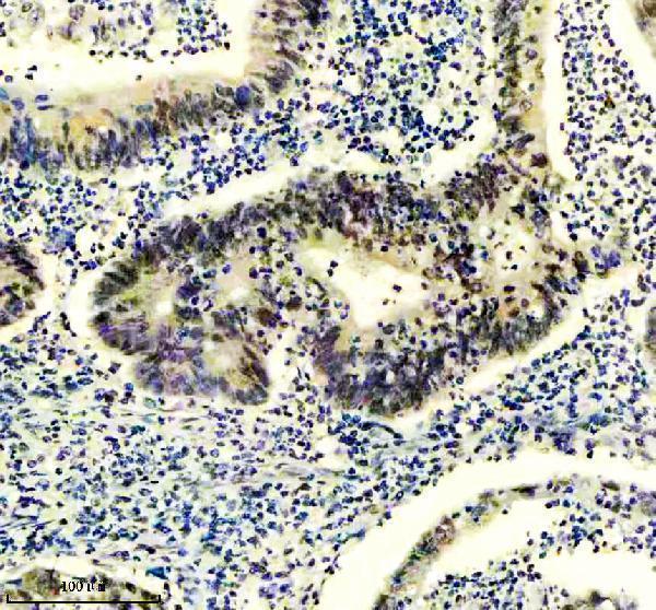 m09194 gatad2a primary antibodies ihc testing 4