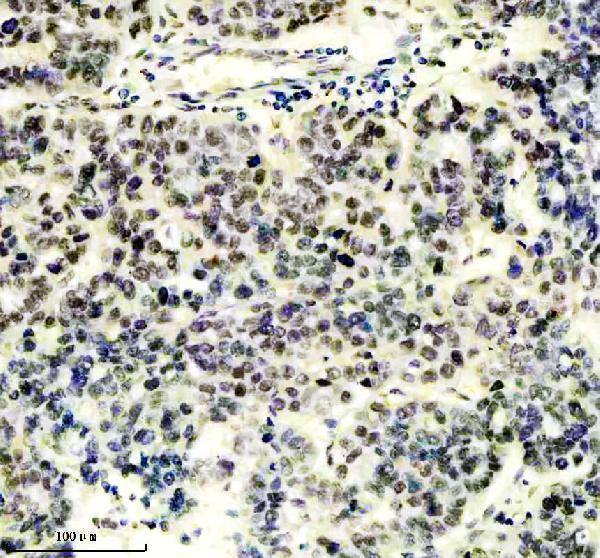 m09194 gatad2a primary antibodies ihc testing 5