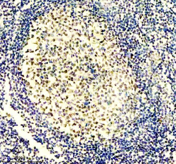 m09194 gatad2a primary antibodies ihc testing 6