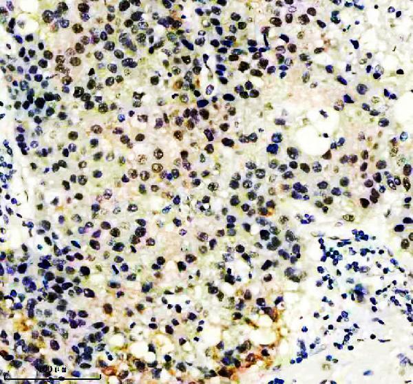 m09194 gatad2a primary antibodies ihc testing 7