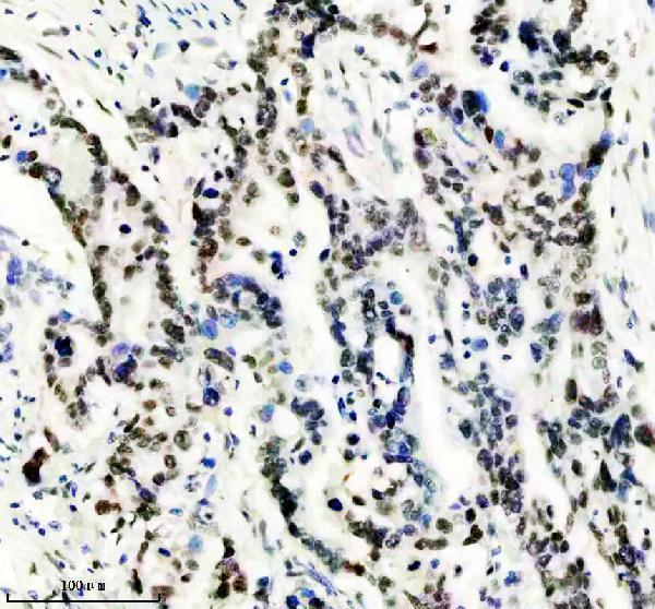 IHC analysis of GATAD2A using anti-GATAD2A antibody (M09194)