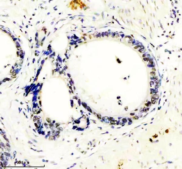 m09194 gatad2a primary antibodies ihc testing 9