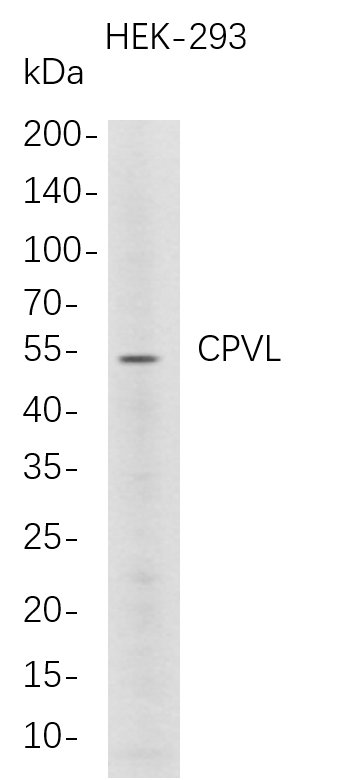 Western Blot analysis of HEK-293  whole cell lysates were separated by 4-20% SDS-PAGE, and the membrane was blotted with anti-CPVL rabbit mAb