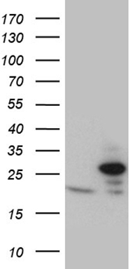 HEK293T cells were transfected with the pCMV6-ENTRY control (Left lane) or pCMV6-ENTRY TIMM23 (Right lane) cDNA for 48 hrs and lysed