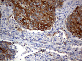 m09220 1 anti bnip1 mouse monoclonal antibody clone id oti2b3 ihc testing 2