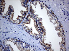 m09220 1 anti bnip1 mouse monoclonal antibody clone id oti2b3 ihc testing 4