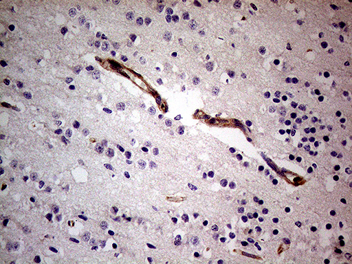 Immunohistochemical staining of paraffin-embedded Human embryonic brain cortex tissue within the normal limits using anti-SEMA3D mouse monoclonal antibody