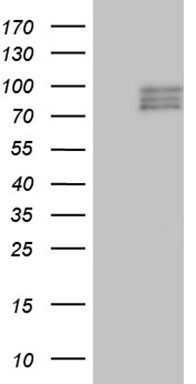 HEK293T cells were transfected with the pCMV6-ENTRY control (Left lane) or pCMV6-ENTRY SEMA3D (Right lane) cDNA for 48 hrs and lysed