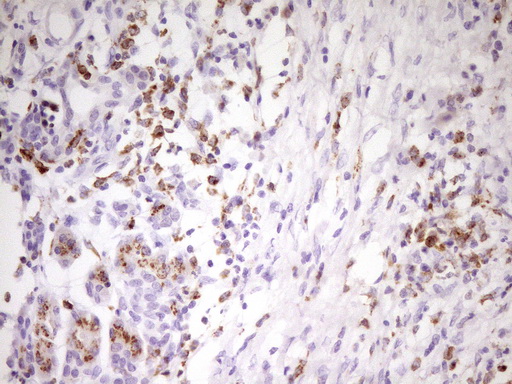 Immunohistochemical staining of paraffin-embedded Human pancreas tissue within the normal limits using anti-APOBR mouse monoclonal antibody