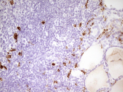m09242 anti apob48r apobr mouse monoclonal antibody clone id oti1b1 ihc testing 4