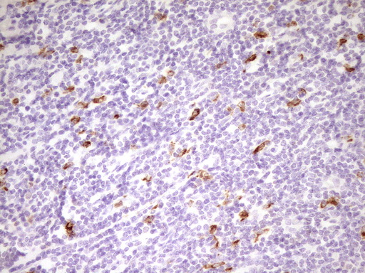 m09242 anti apob48r apobr mouse monoclonal antibody clone id oti1b1 ihc testing 6