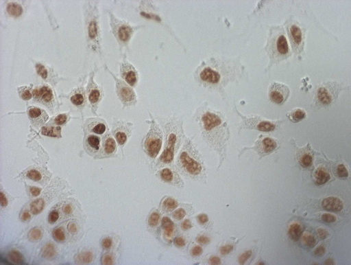 m09247 1 anti nudt21 mouse monoclonal antibody clone id oti1b1 if testing 20