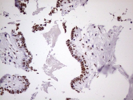 m09247 1 anti nudt21 mouse monoclonal antibody clone id oti1b1 ihc testing 10
