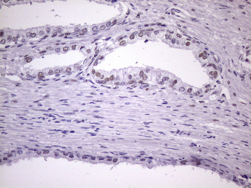 m09247 1 anti nudt21 mouse monoclonal antibody clone id oti1b1 ihc testing 11