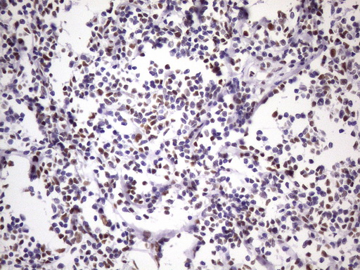 m09247 1 anti nudt21 mouse monoclonal antibody clone id oti1b1 ihc testing 12