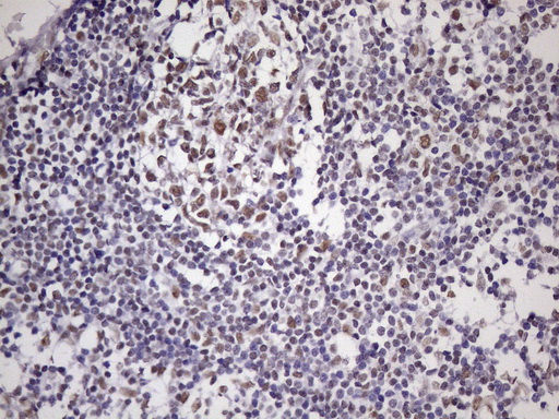 m09247 1 anti nudt21 mouse monoclonal antibody clone id oti1b1 ihc testing 13