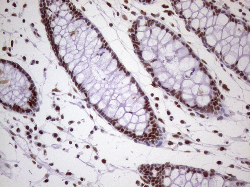 m09247 1 anti nudt21 mouse monoclonal antibody clone id oti1b1 ihc testing 15