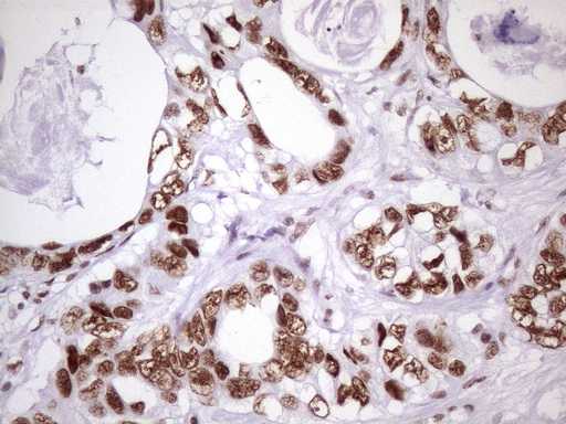 m09247 1 anti nudt21 mouse monoclonal antibody clone id oti1b1 ihc testing 16