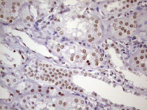 m09247 1 anti nudt21 mouse monoclonal antibody clone id oti1b1 ihc testing 17