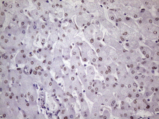 m09247 1 anti nudt21 mouse monoclonal antibody clone id oti1b1 ihc testing 18