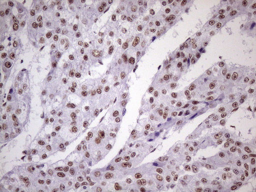 m09247 1 anti nudt21 mouse monoclonal antibody clone id oti1b1 ihc testing 19
