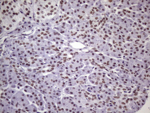 m09247 1 anti nudt21 mouse monoclonal antibody clone id oti1b1 ihc testing 4