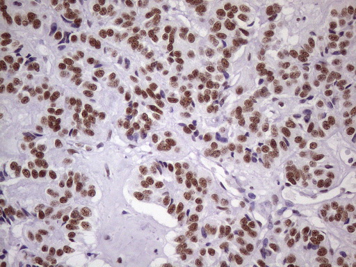 m09247 1 anti nudt21 mouse monoclonal antibody clone id oti1b1 ihc testing 5