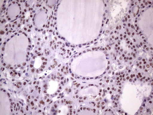 m09247 1 anti nudt21 mouse monoclonal antibody clone id oti1b1 ihc testing 6