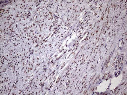 m09247 1 anti nudt21 mouse monoclonal antibody clone id oti1b1 ihc testing 7