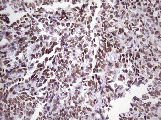 m09247 1 anti nudt21 mouse monoclonal antibody clone id oti1b1 ihc testing 8