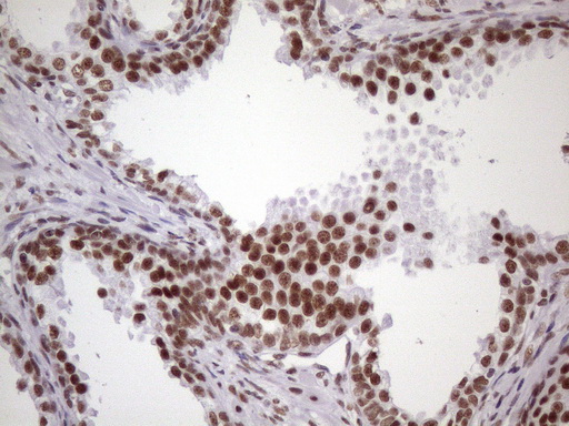 m09247 1 anti nudt21 mouse monoclonal antibody clone id oti1b1 ihc testing 9