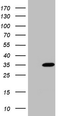 HEK293T cells were transfected with the pCMV6-ENTRY control (Left lane) or pCMV6-ENTRY NUDT21 (Right lane) cDNA for 48 hrs and lysed