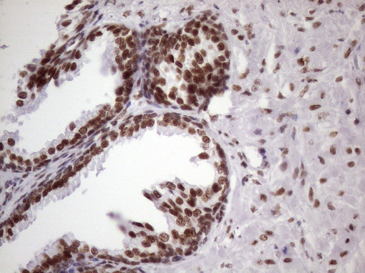 m09247 anti nudt21 mouse monoclonal antibody clone id oti13h1 ihc testing 10