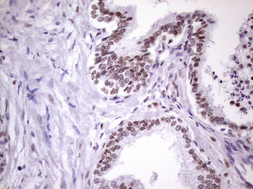 m09247 anti nudt21 mouse monoclonal antibody clone id oti13h1 ihc testing 11
