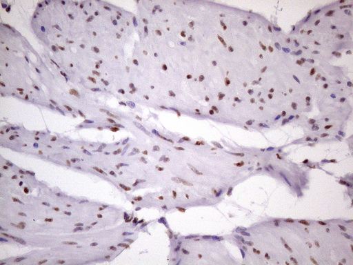 m09247 anti nudt21 mouse monoclonal antibody clone id oti13h1 ihc testing 12