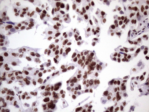 m09247 anti nudt21 mouse monoclonal antibody clone id oti13h1 ihc testing 13