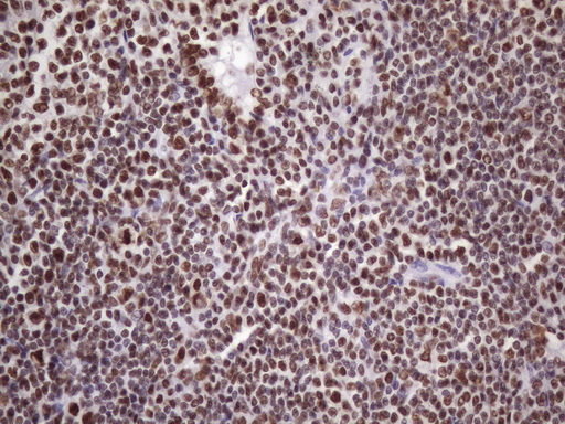 m09247 anti nudt21 mouse monoclonal antibody clone id oti13h1 ihc testing 14