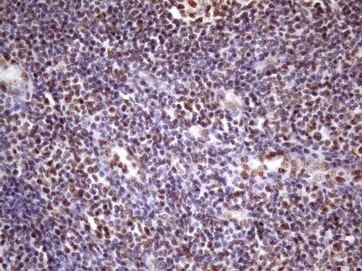 m09247 anti nudt21 mouse monoclonal antibody clone id oti13h1 ihc testing 15